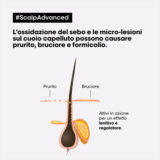 L'Oreal Professionnel Paris Scalp Advanced Anti-Discomfort Shampoo 500ml - shampoo lenitivo