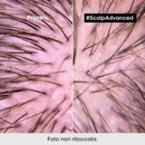 L'Oreal Professionnel Paris Scalp Advanced Anti-Discomfort Shampoo 500ml - shampoo lenitivo